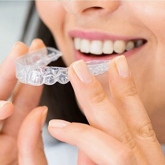 The Benefits of Invisalign and Clear Aligners - MyOrthodontist - invisalign and clear aligners,benefits benefits of invisalign and clear aligners