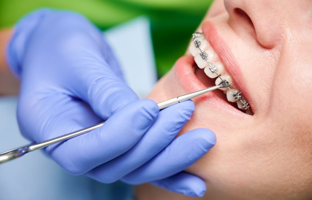 Discover 5 Steps to Find an Orthodontist Near Me: Unveiling Orthodontics - MyOrthodontist - nj orthodontist,orthodontist near me nj orthodontist, orthodontist near me