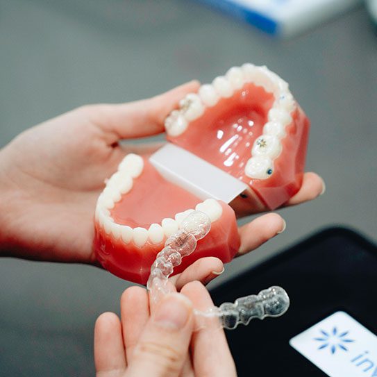 The Orthodontic Issues Invisalign Is Best At Correcting - MyOrthodontist - two-phase orthodontic treatment,two-phase orthodontics,orthodontic treatment The Orthodontic Issues Invisalign Is Best At Correcting