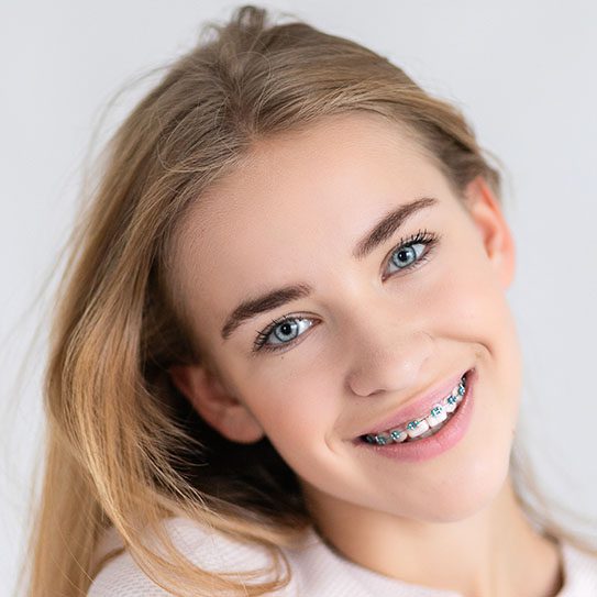 Why Is Budgeting for Braces Worth It?