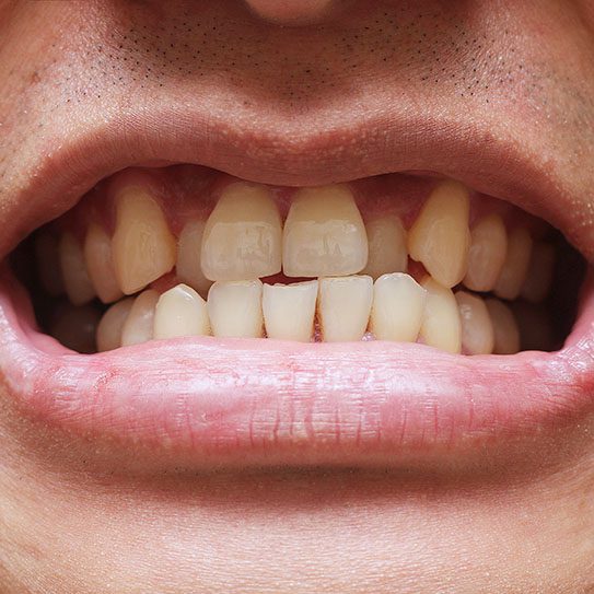 Common Orthodontic Issues and Their Solutions