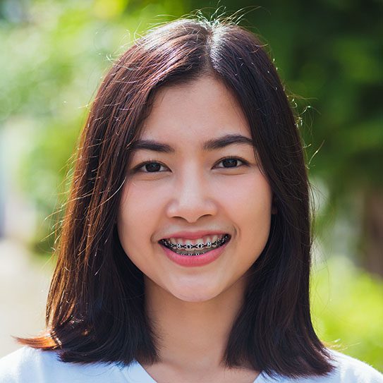 Everything to Know About Teen Braces - MyOrthodontist - Invisalign,Invisalign care teen braces when to get my child braces
