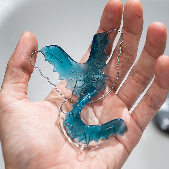 10 Tips for Taking Care of Your Retainers - MyOrthodontist - retainers,tips for retainers tips for retainers