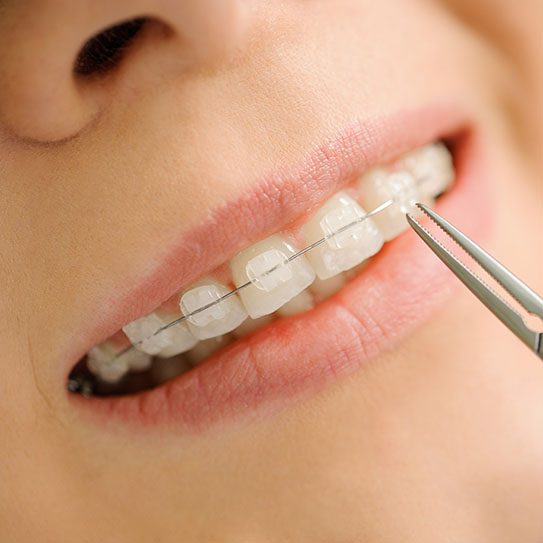 Different Levels of Orthodontics - MyOrthodontist - orthodontics,orthodontic treatment orthodontics orthodontic treatment