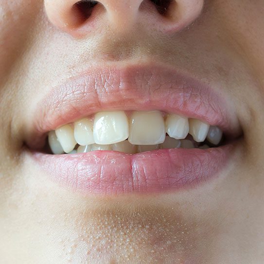 Why Seeing an Orthodontist (Instead of a Dentist) Is Worth It - MyOrthodontist - orthodontist orthodontist