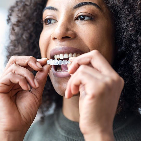 Invisalign for Busy Professionals: Discreet, Convenient, Effective - MyOrthodontist - Invisalign affordable clear aligners orthodontist
