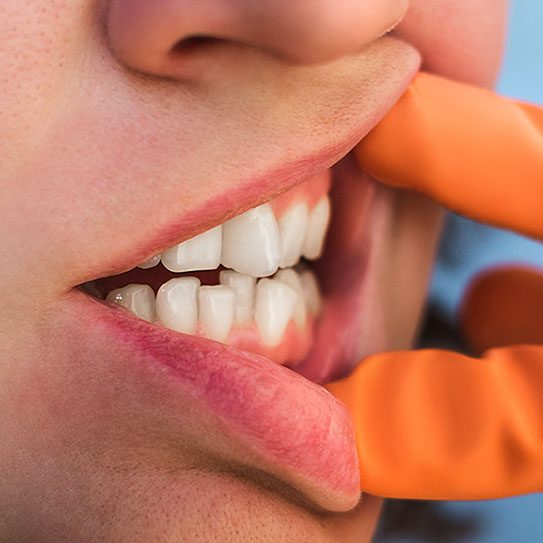 How Do Crooked Teeth Affect Clear Speech? - MyOrthodontist - MyOrthodontist -