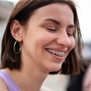 Orthodontics Blog - MyOrthodontist - braces West Orange Invisalign West Orange orthodontist West Orange