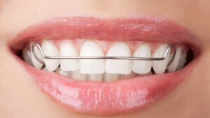 Orthodontics Blog - MyOrthodontist - braces specialist in Deptford Township